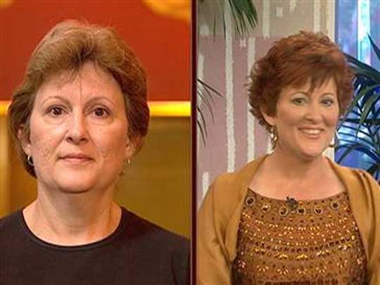 The before and after