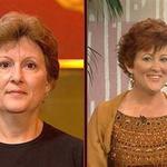 The before and after